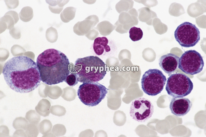 moelle osseuse x200 - gryphea.org